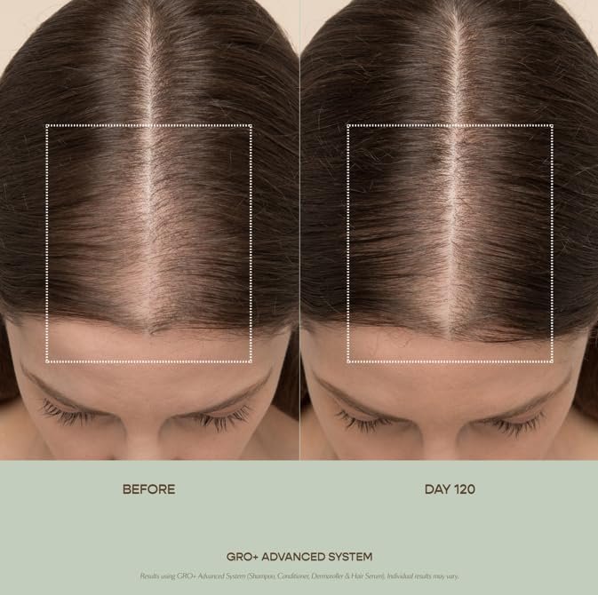 51kLDQnP6tL.jpg VEGAMOUR GRO+ Hair Serum - Image 3
