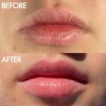 Lanolips Lip Balm Duo - Image 3