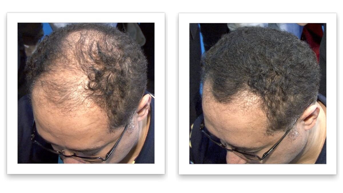 Caboki Hair Building Fiber - Image 3