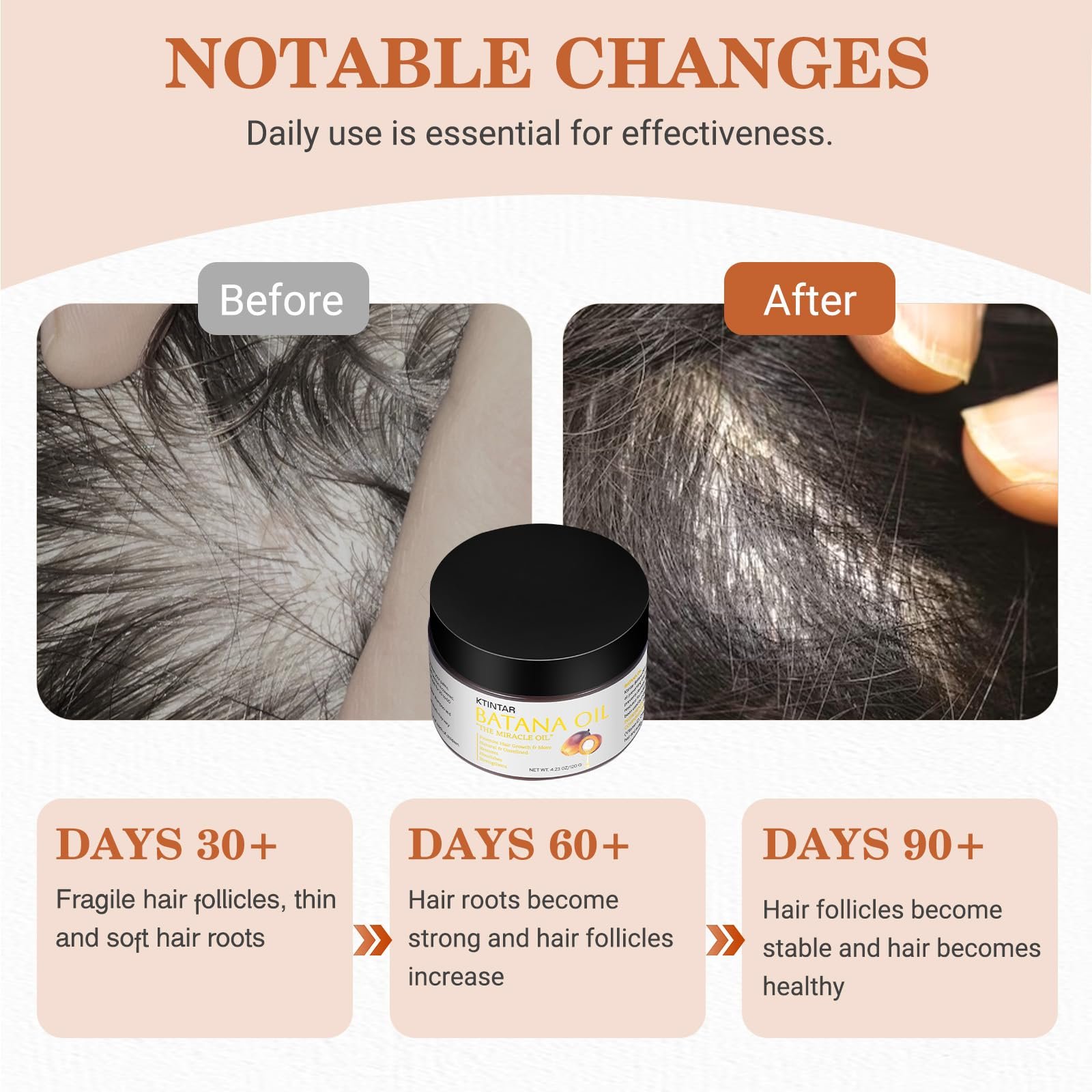 714eUcnb3VL.jpg Batana Hair Growth Oil - Image 4