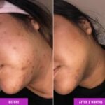 Good Molecules Skin Brightening Serum - Image 4