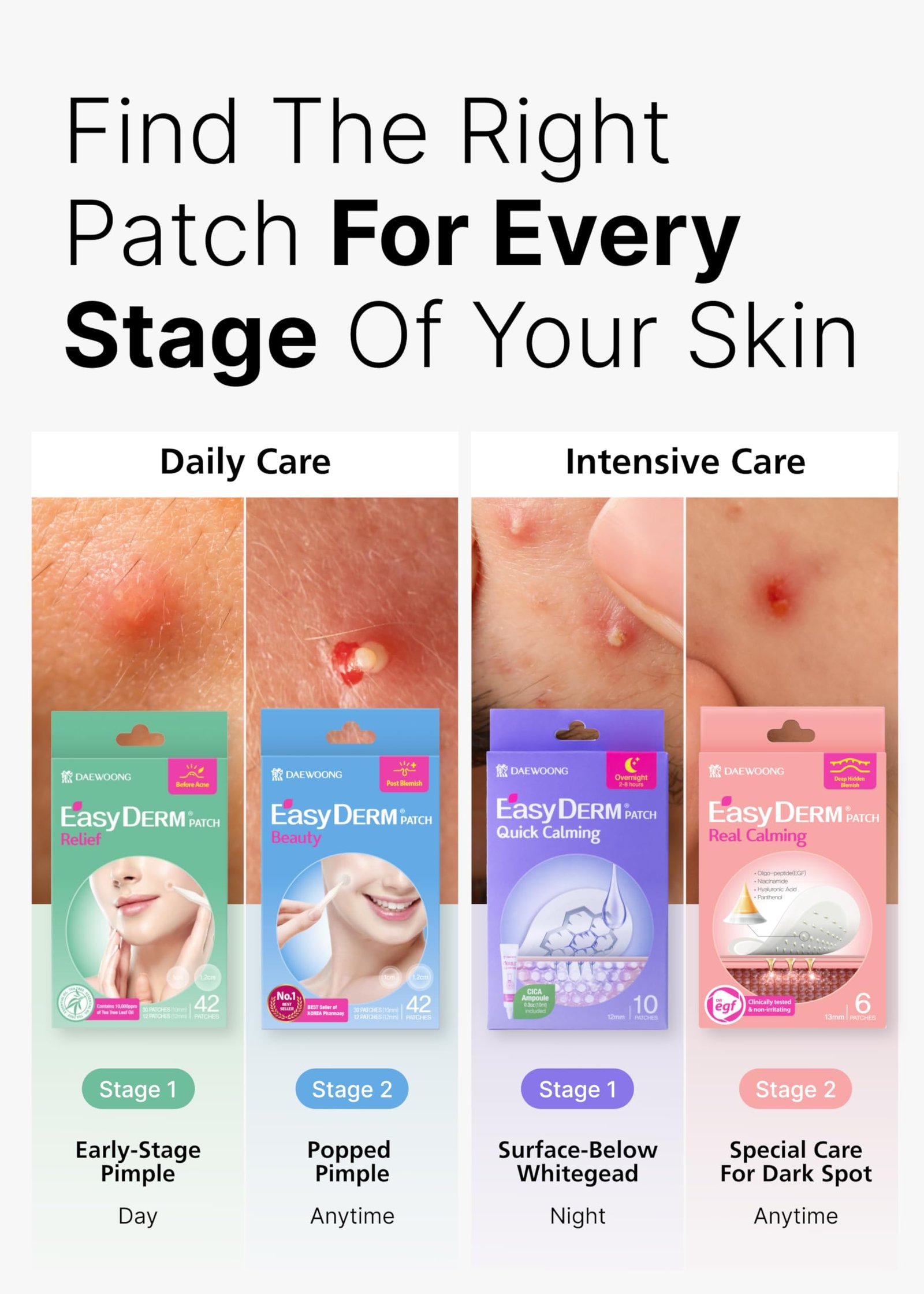716HIQPlIFL.jpg Easyderm Tea Tree Patch Set - Image 3