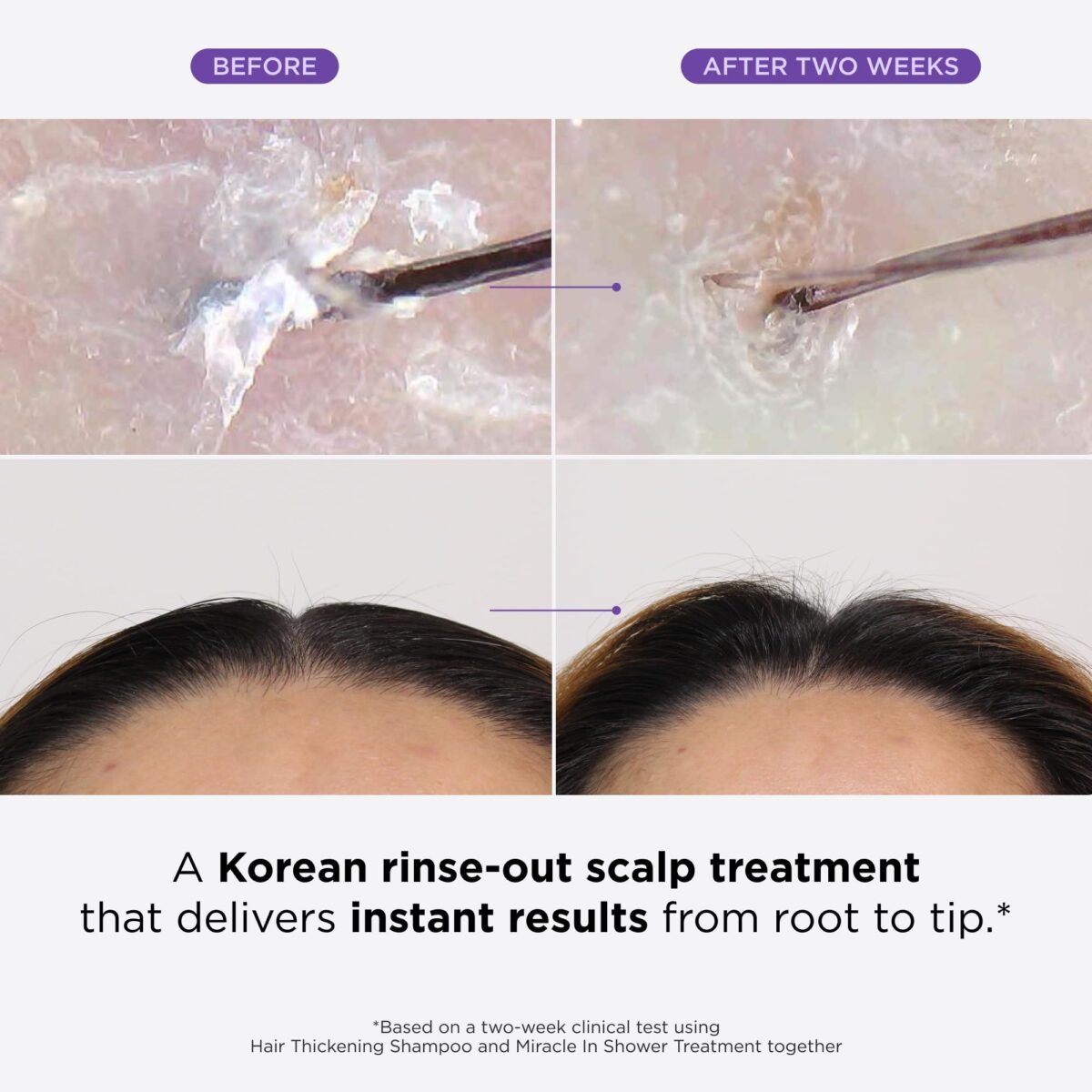 Dr. Groot Hair Loss Treatment - Image 2