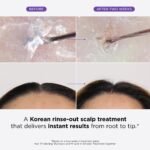 Dr. Groot Hair Loss Treatment - Image 2