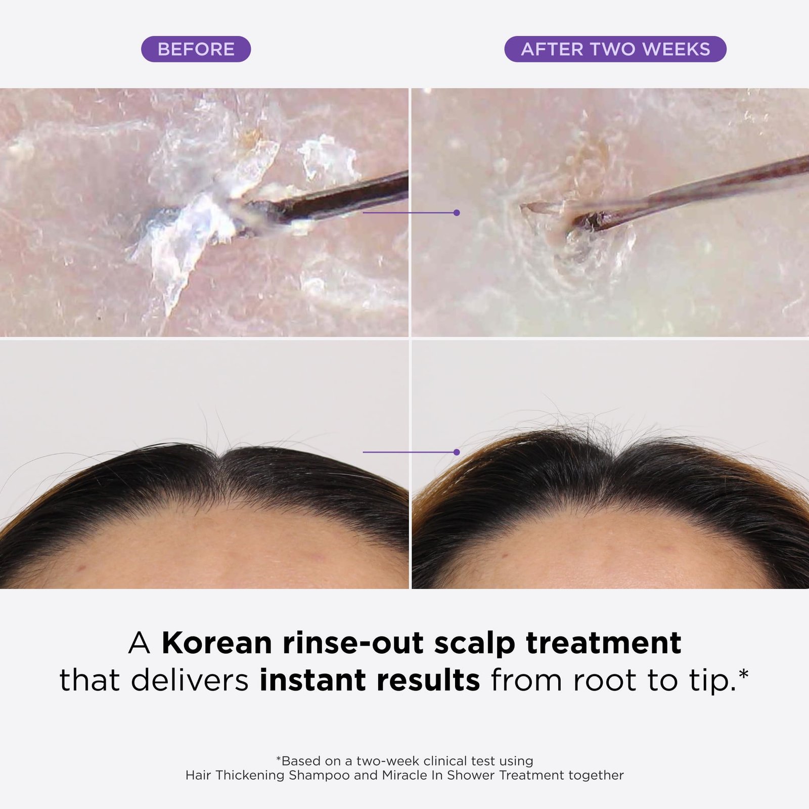 716YU2OqUPL.jpg Dr. Groot Hair Loss Treatment - Image 2