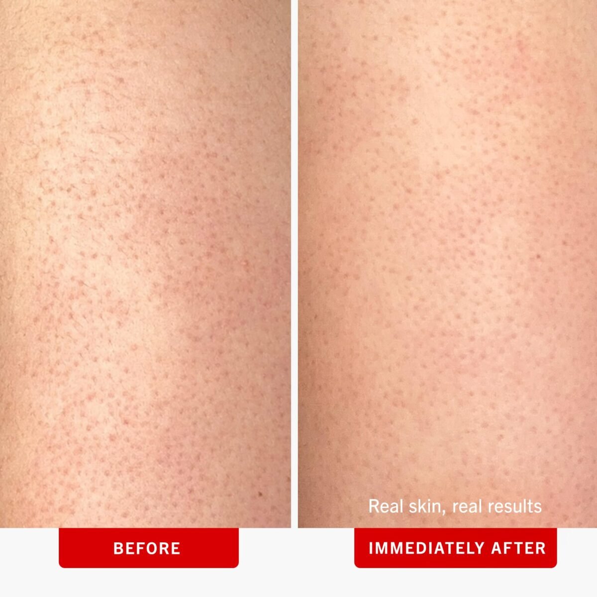 First Aid Beauty KP Bump Eraser Scrub - Image 3