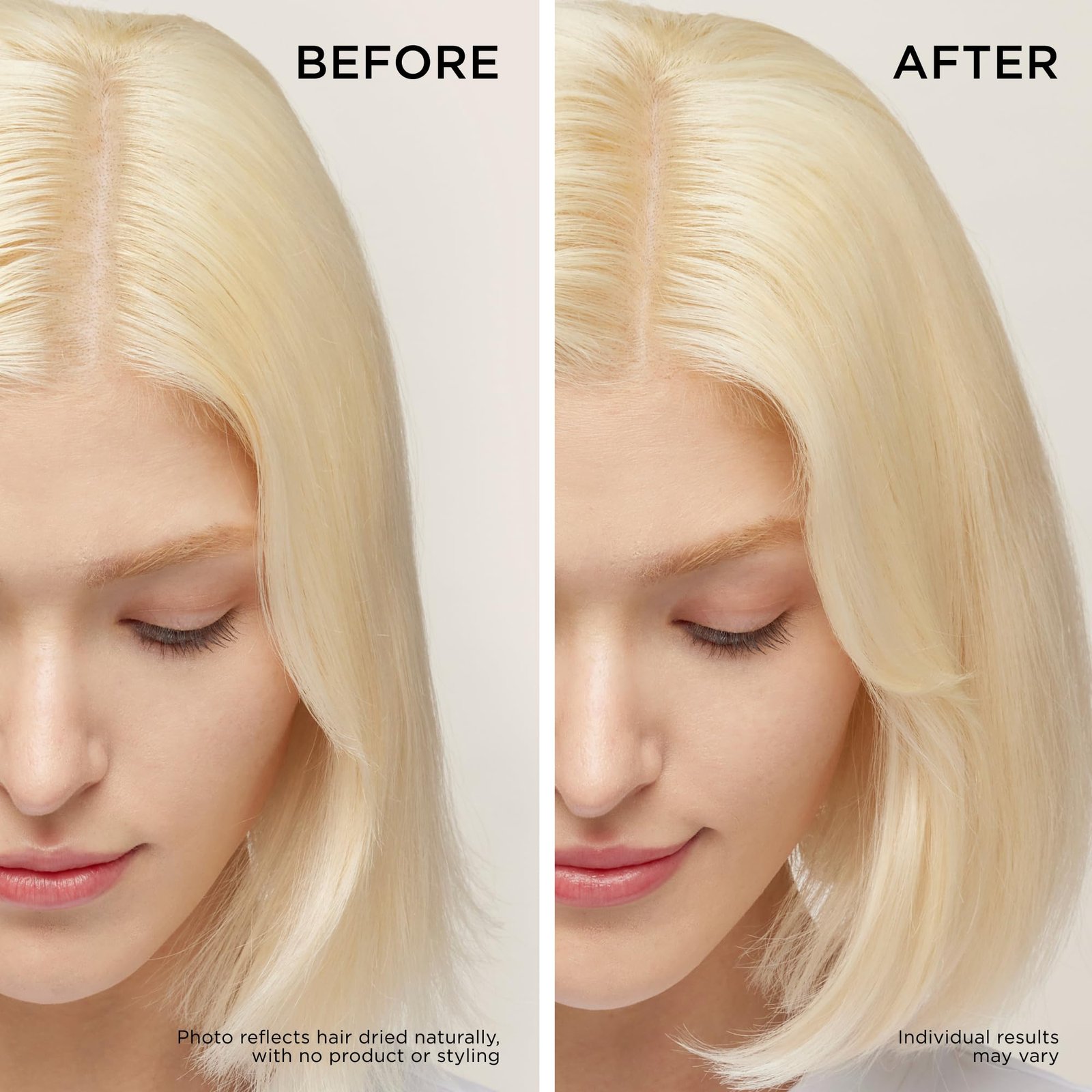 71A9Cx1sF3L.jpg Dr. Groot Hair Loss Treatment - Image 5