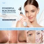 CHIMOCEE Pore Vacuum - Image 2