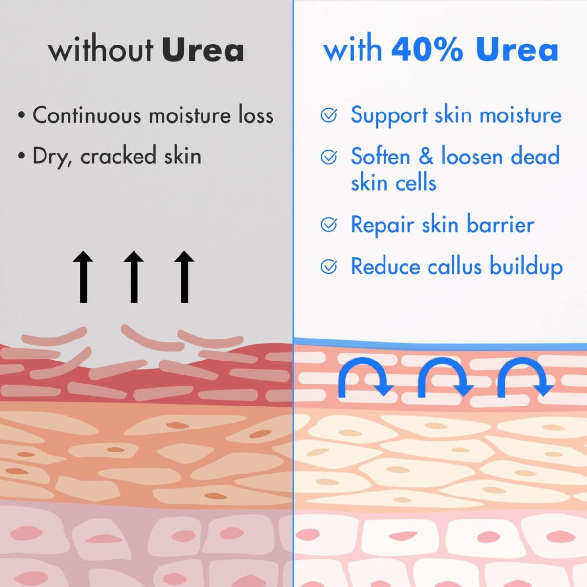 Ebanel Urea Foot Cream 40% - Image 5