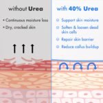 Ebanel Urea Foot Cream 40% - Image 5