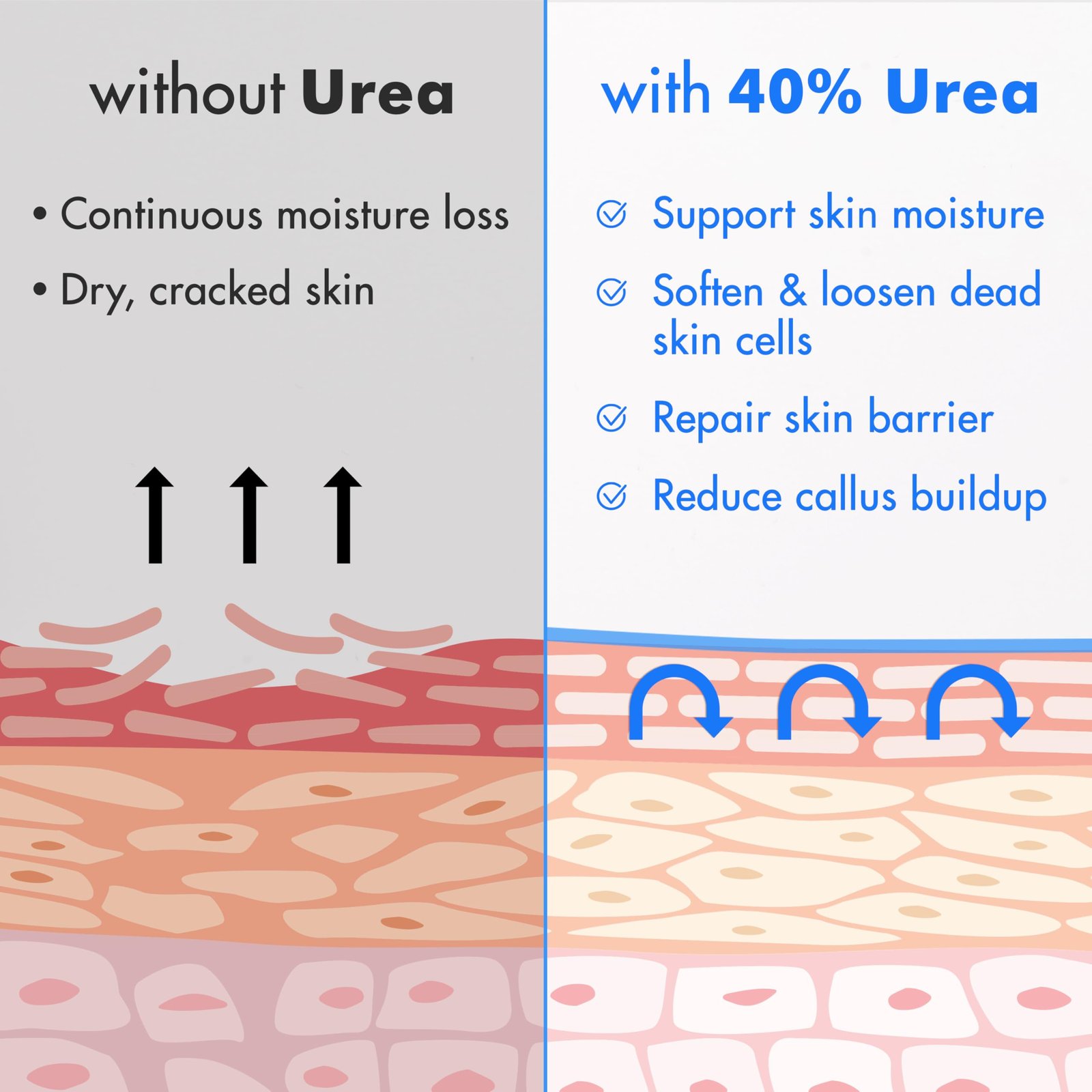 71Bs1WOhNRL.jpg Ebanel Urea Foot Cream 40% - Image 5