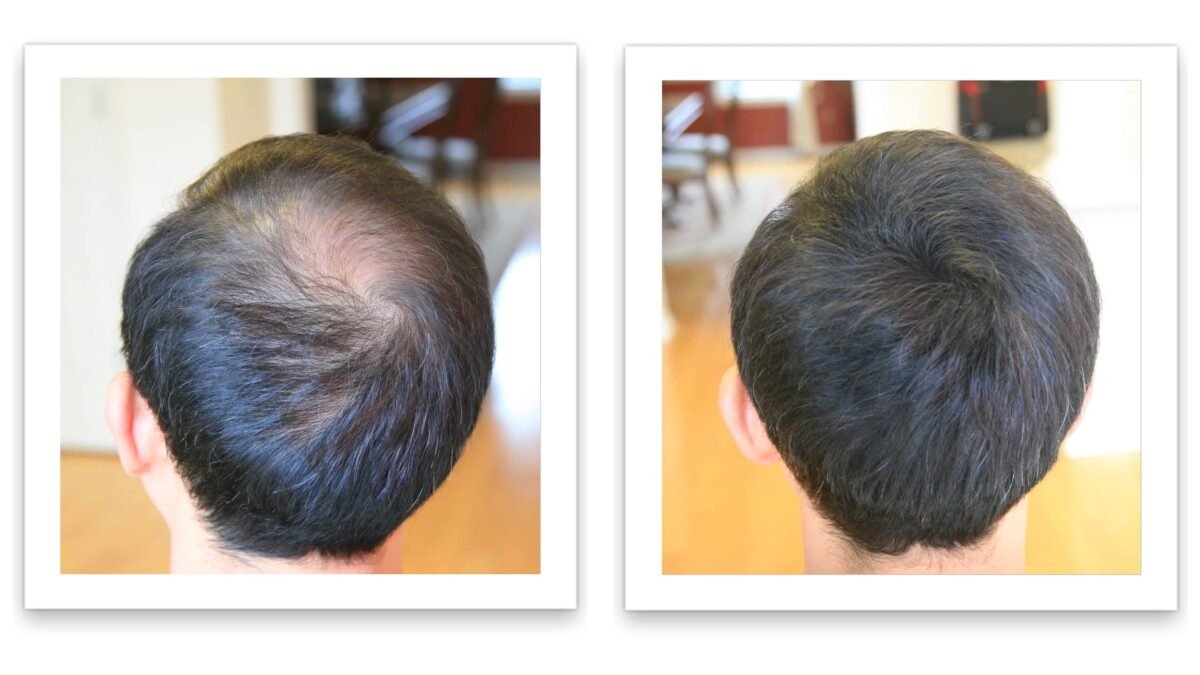 Caboki Hair Building Fiber - Image 7
