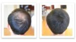 Caboki Hair Building Fiber - Image 7