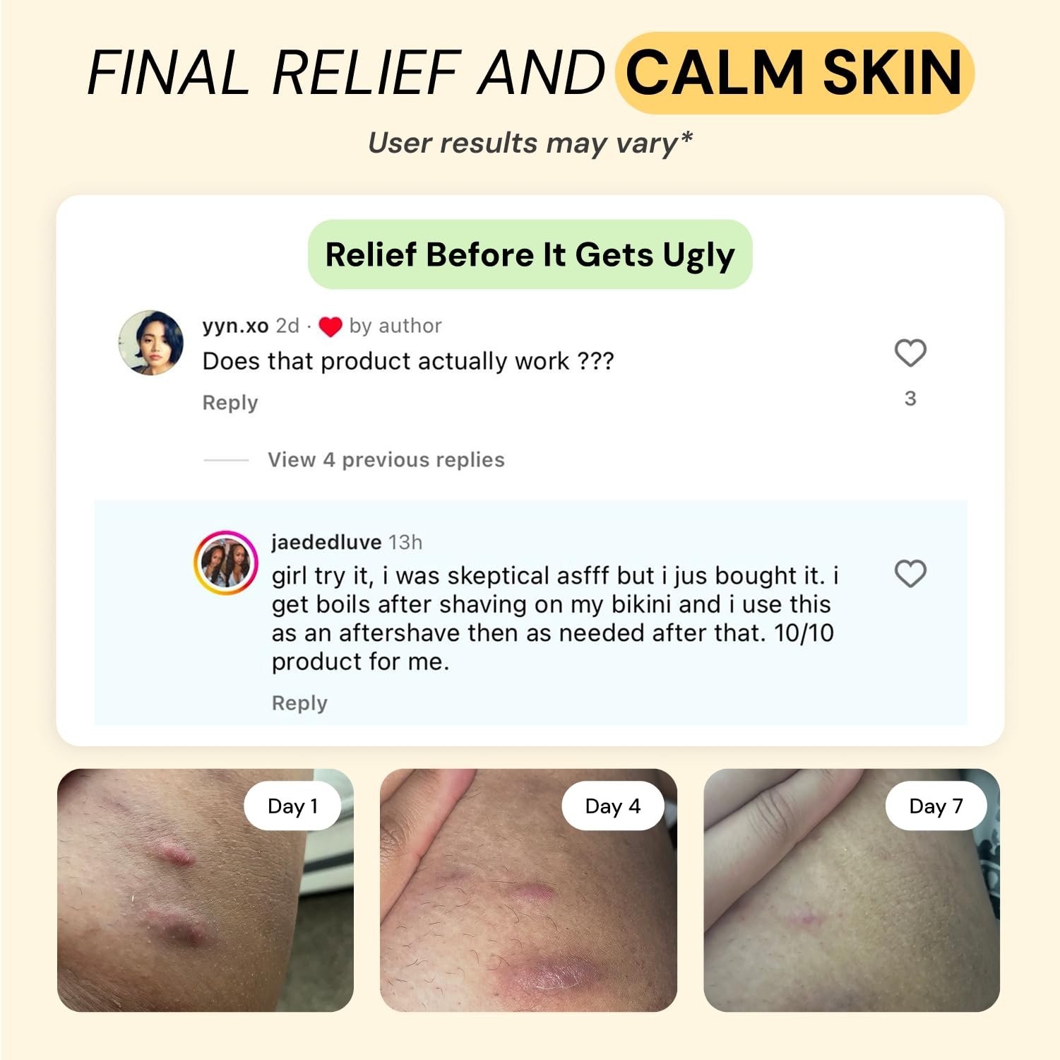 71D7Qt9orPL.jpg Skin Relief Solution - Image 4