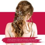 Yzmoffer Minoxidil Foam Women - Image 7