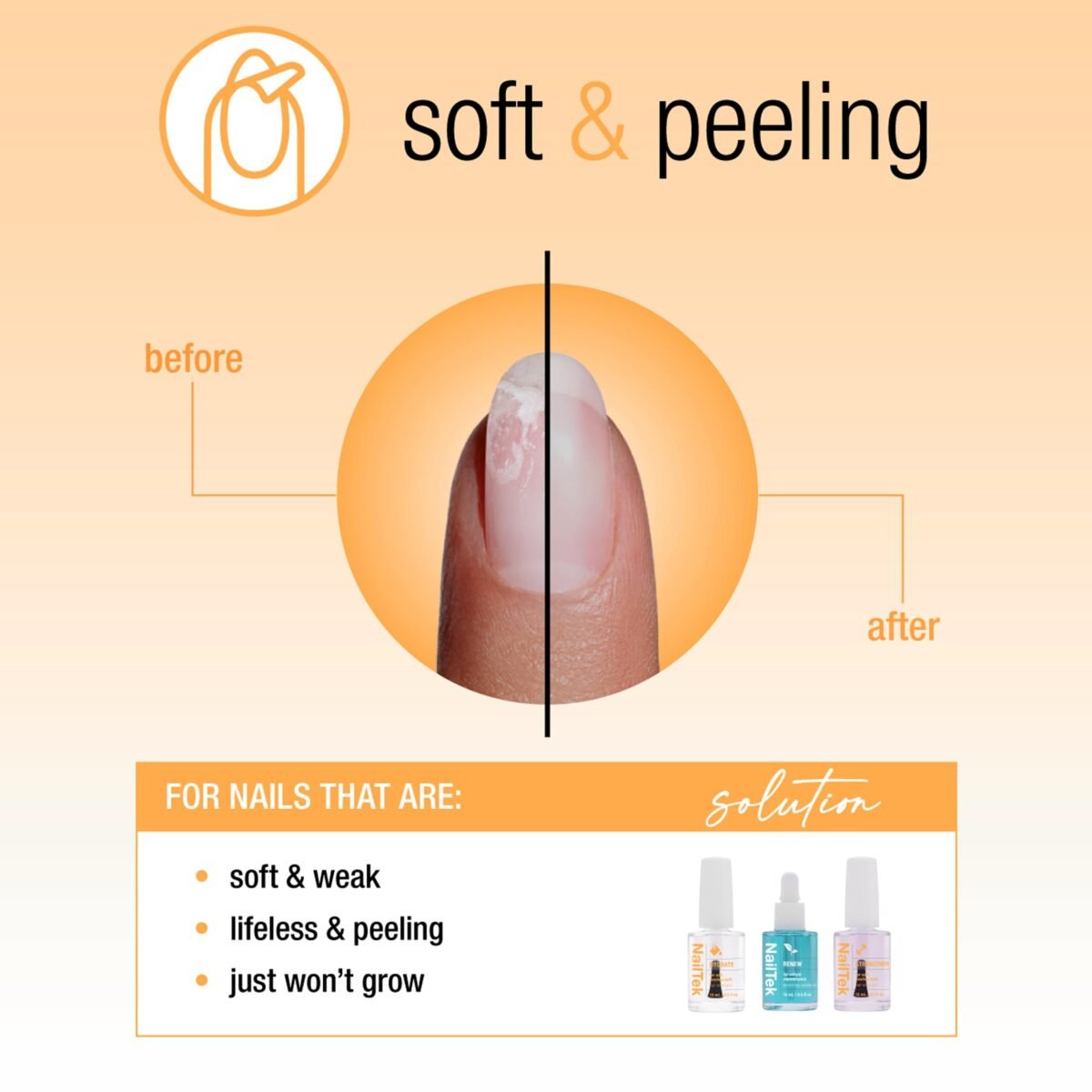 Nail Tek Recovery Kit - Image 2