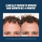 Nutrafol Men's Hair Growth Supplements - Image 4