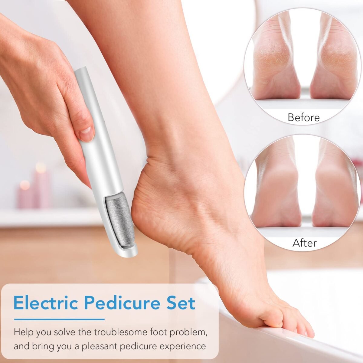 Professional Electric Callus Remover - Image 2