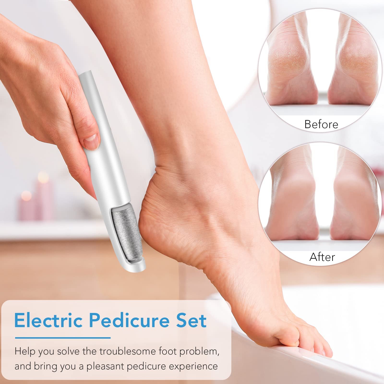 71QzrkzyPxL.jpg Professional Electric Callus Remover - Image 2