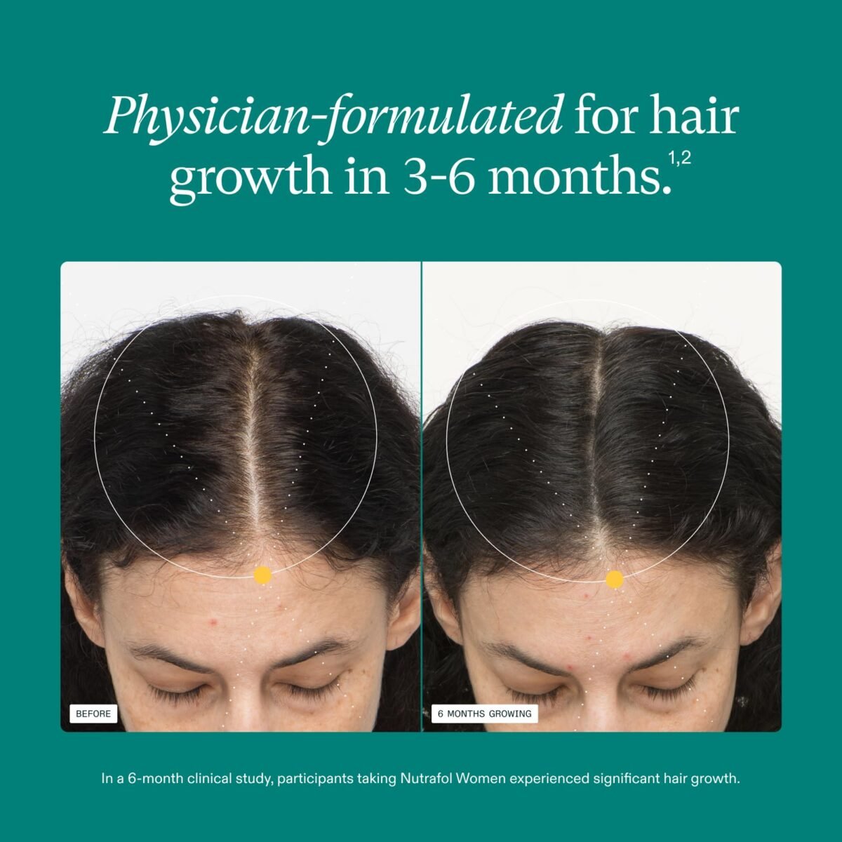 Nutrafol Women's Hair Growth Supplement - Image 4