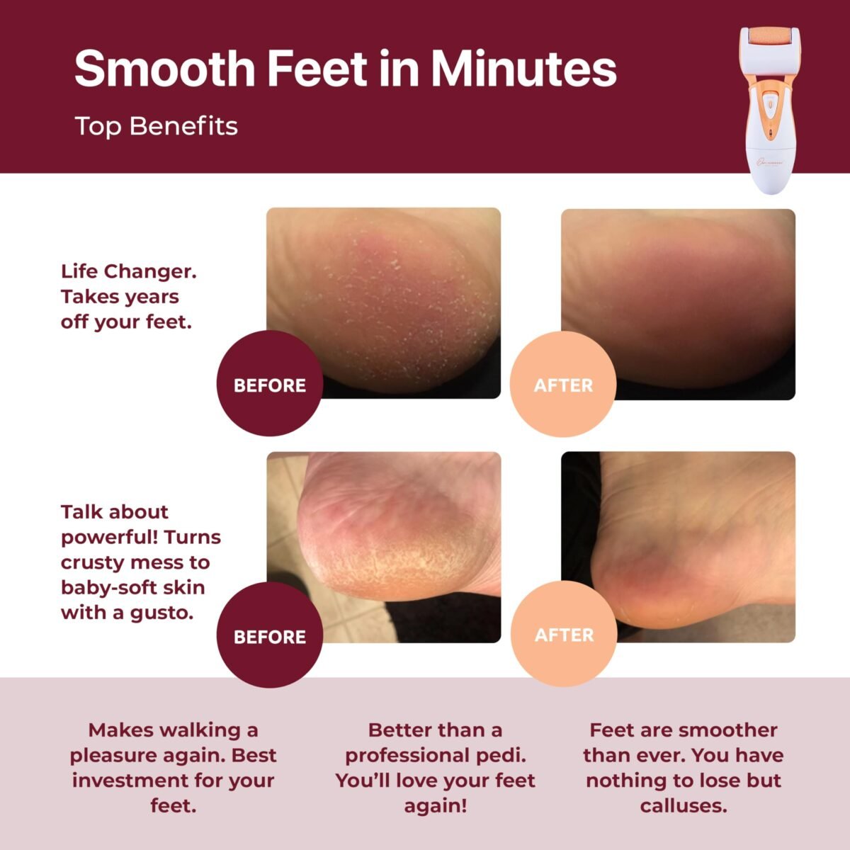 Professional Electric Foot Callus Remover - Image 2