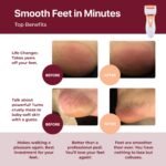 Professional Electric Foot Callus Remover - Image 2