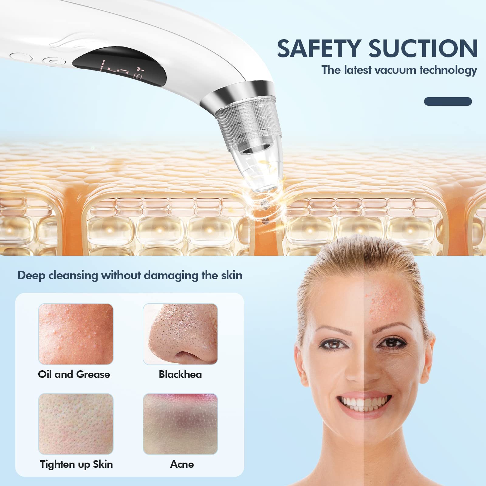 71ZhqPMYv7L.jpg CHIMOCEE Pore Vacuum - Image 5