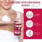 Yzmoffer Minoxidil Foam Women - Image 3