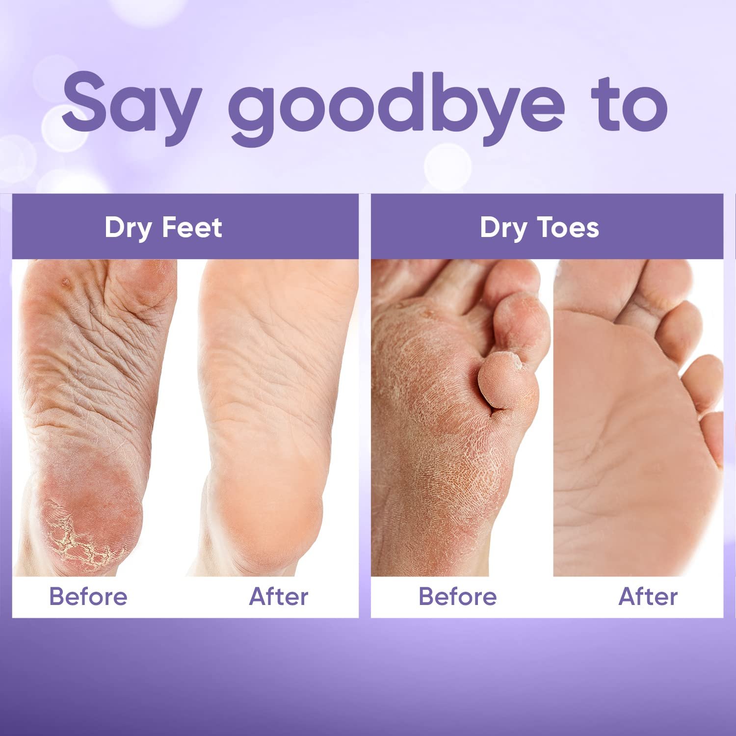 71hglEB-koL.jpg Celor Foot Peel Mask - Image 4
