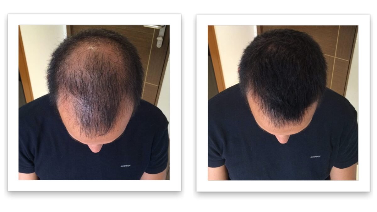 Caboki Hair Building Fiber - Image 8