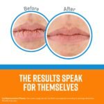 O'Keeffe's Lip Repair Lip Balm - Image 2