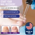 ZanaQuick Nail Treatment Drops - Image 2