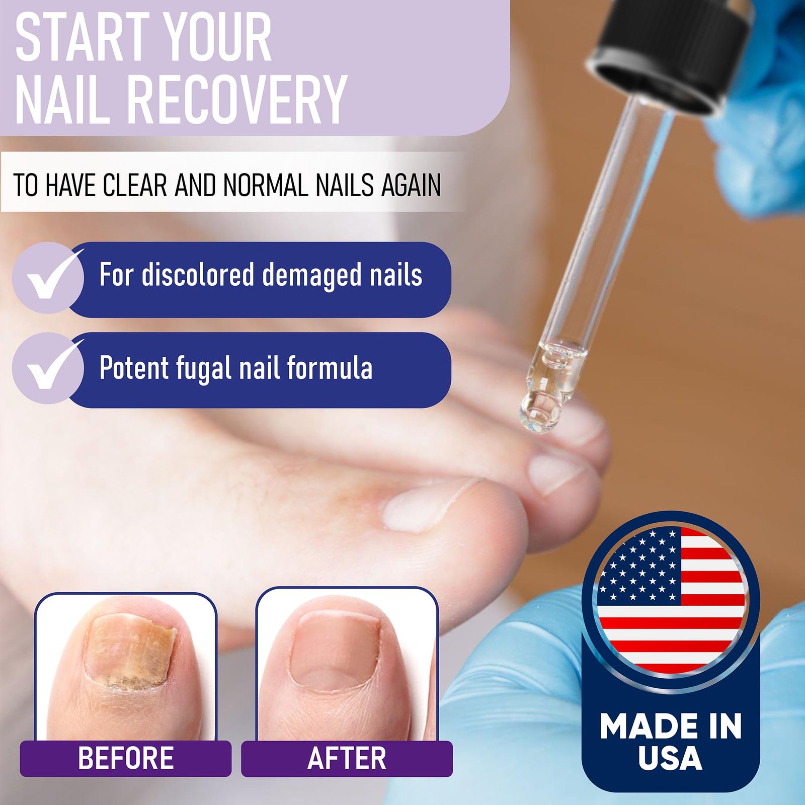 71vPfzHzF7L.jpg ZanaQuick Nail Treatment Drops - Image 2