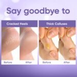 Celor Foot Peel Mask - Image 5