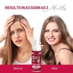 Yzmoffer Minoxidil Foam Women - Image 6