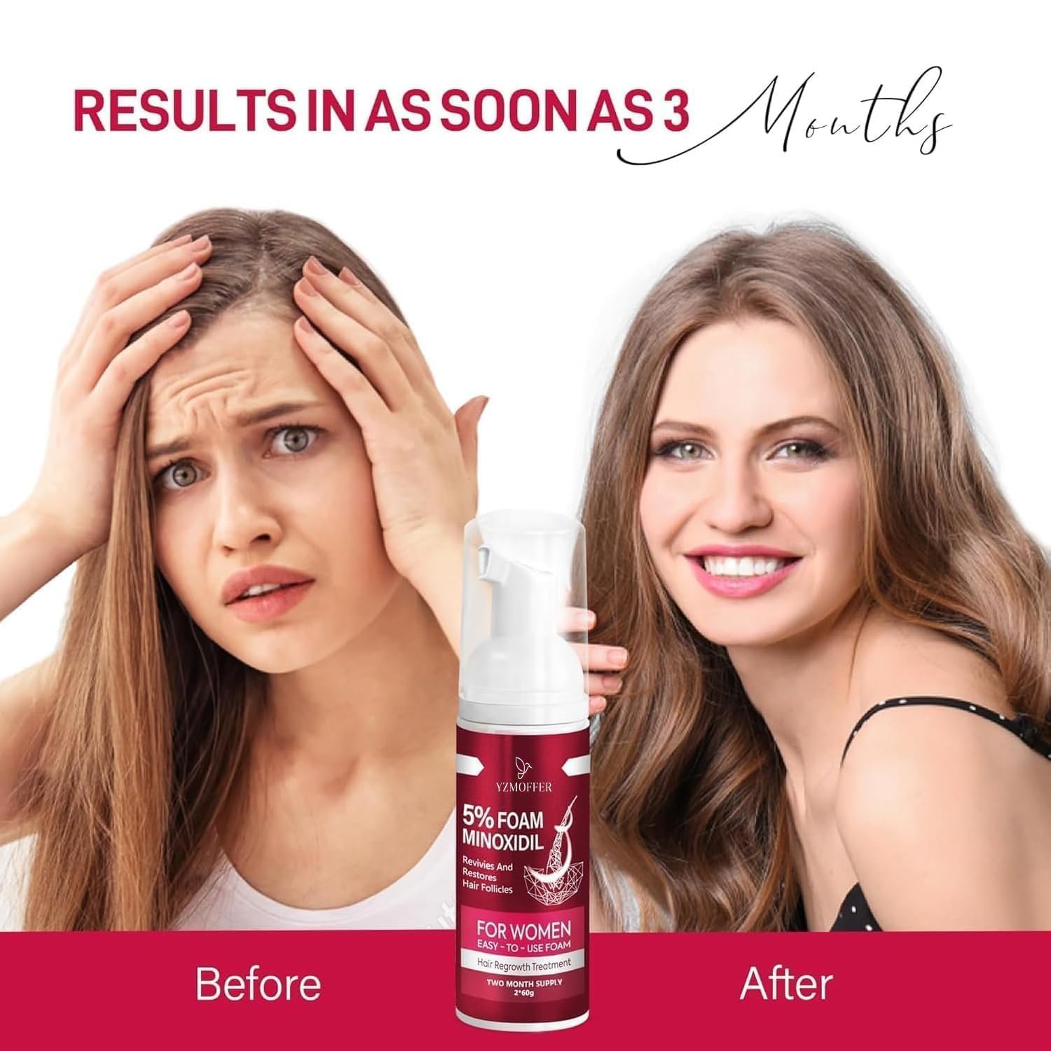 71xP-G1BNVL.jpg Yzmoffer Minoxidil Foam Women - Image 6