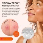 ZitSticka Extra Strength Acne Patch - Image 2