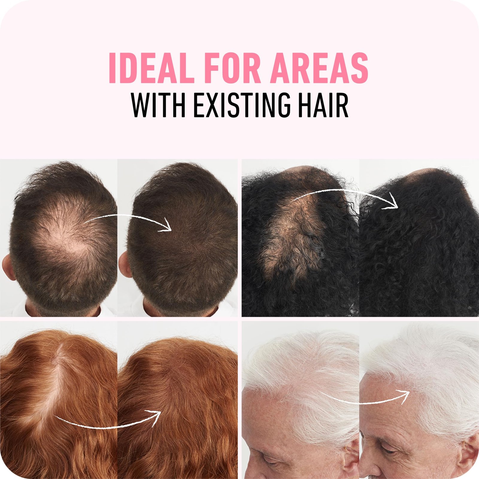 81I0oUeDdL.jpg Boldify Hair Fibers - Image 4