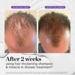 Dr. Groot Hair Loss Treatment - Image 8