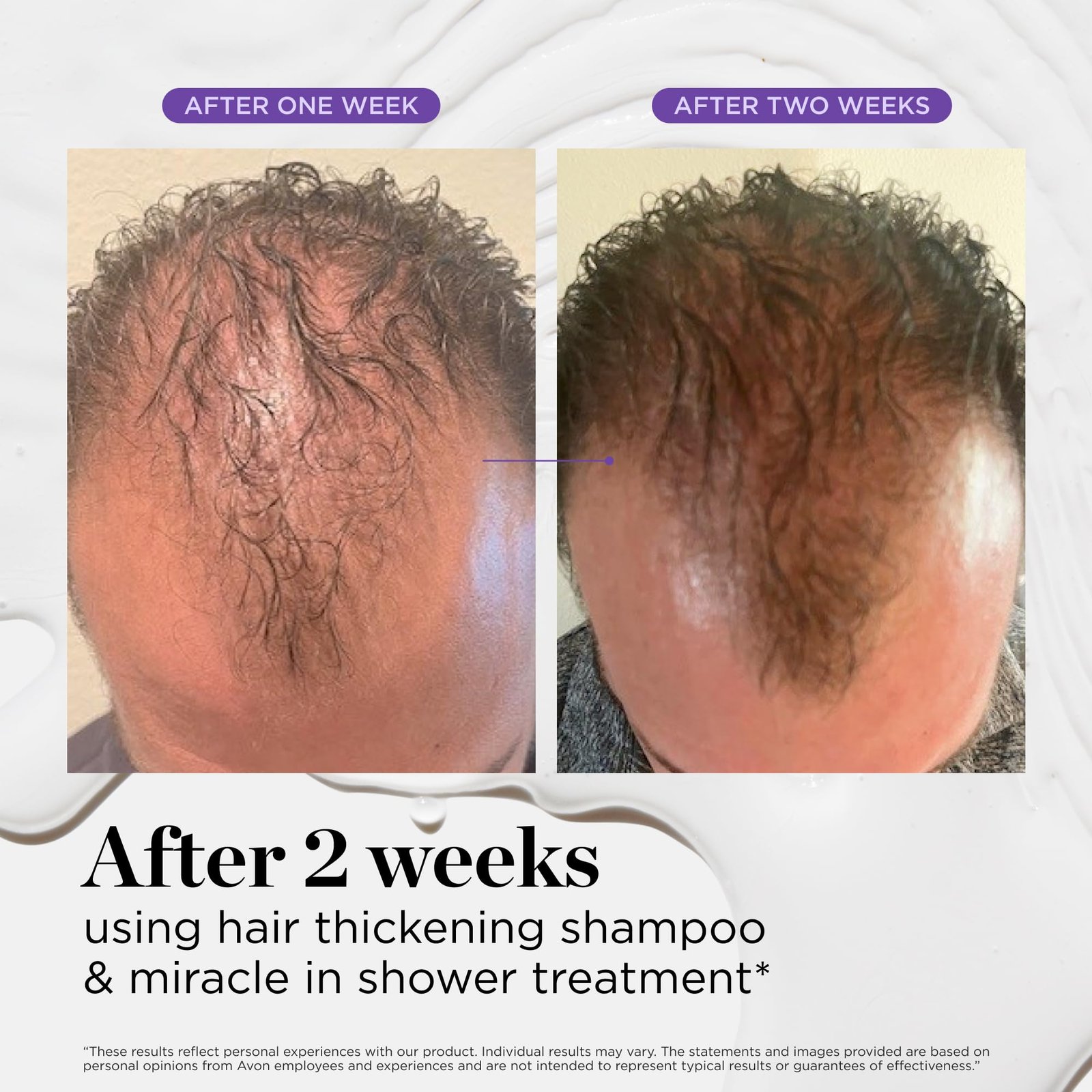 81JHvaZqqTL.jpg Dr. Groot Hair Loss Treatment - Image 8