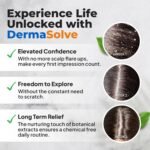 Dermasolve Scalp Relief Oil - Image 5