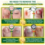 Titanium Ingrown Toenail Kit - Image 4