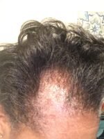 Kreyol Essence Black Castor Oil - Image 7