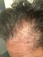 Kreyol Essence Black Castor Oil - Image 8