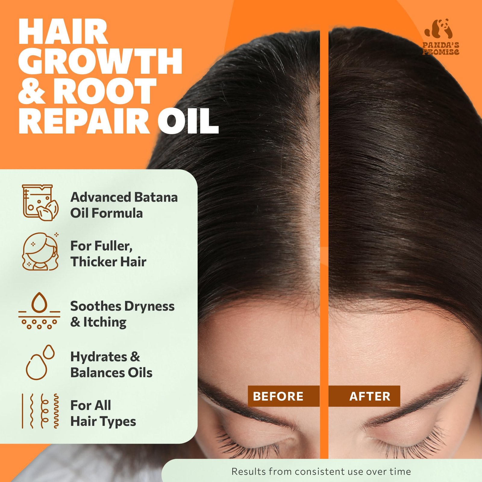 81Ucy38E9GL.jpg Batana Hair Growth Oil - Image 6