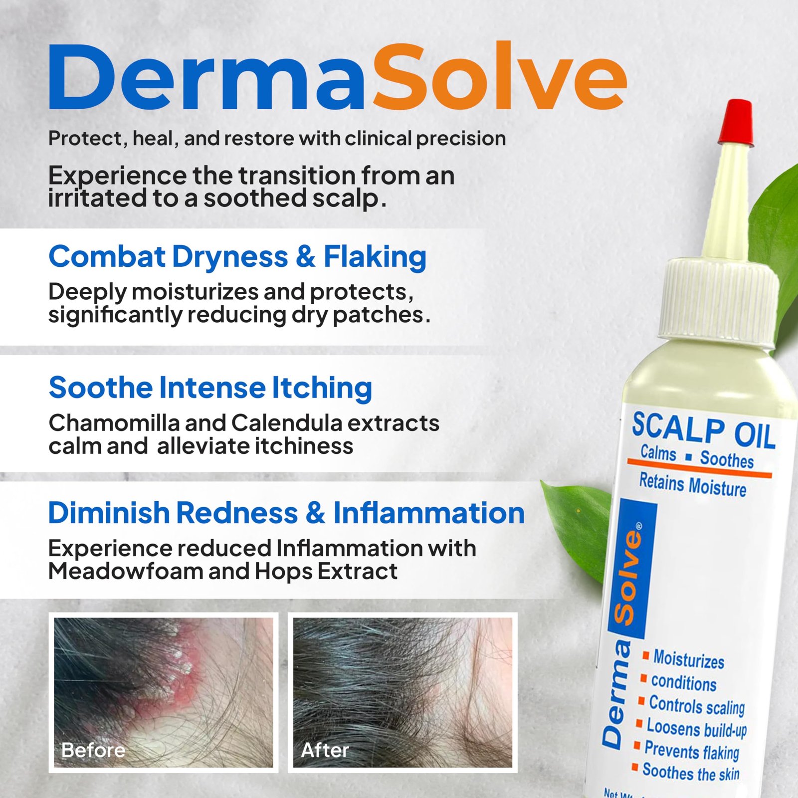 81a1dy607PL.jpg Dermasolve Scalp Relief Oil - Image 2