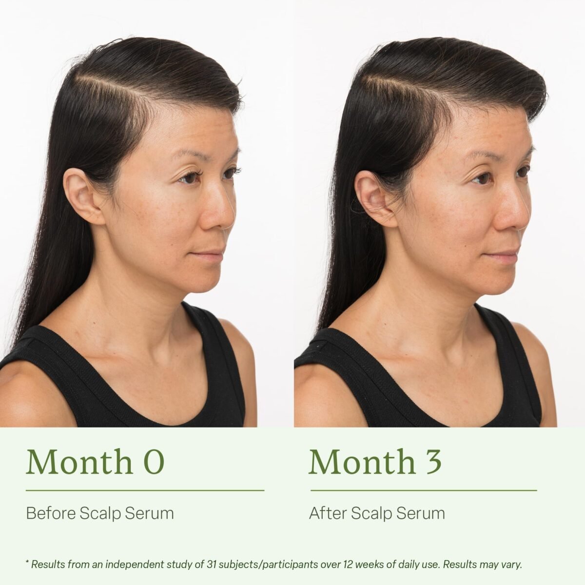 Divi Scalp Serum for Thinning Hair - Image 5