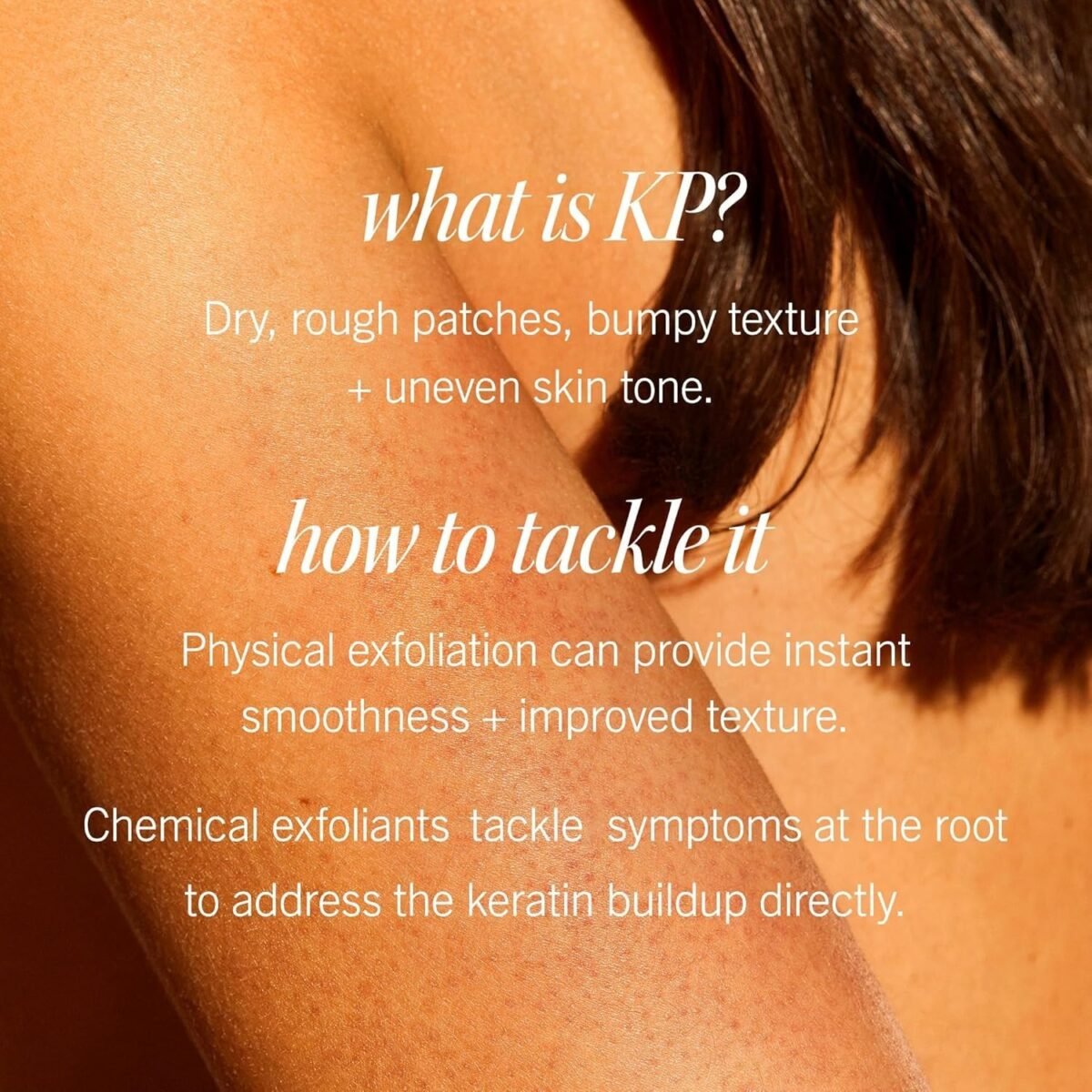 First Aid Beauty KP Bump Eraser Scrub - Image 4