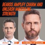 Beard Growth Serum for Men - Image 2