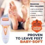 Professional Electric Foot Callus Remover - Image 3